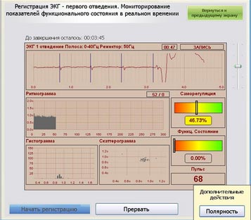 ЭКГ первого отведения